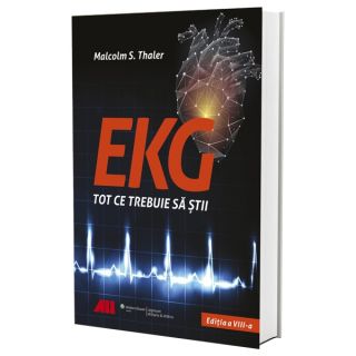 EKG - Tot ce trebuie să știi